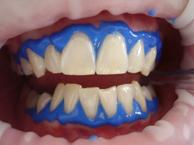 tooth whitening